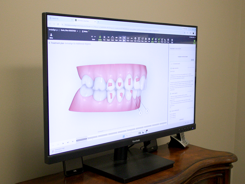 gum disease